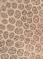 Leptostomum inclinans