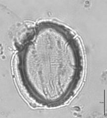 Cocconeis