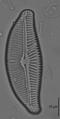 Encyonema