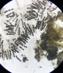 Podospora anserina