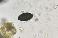 Podospora anserina