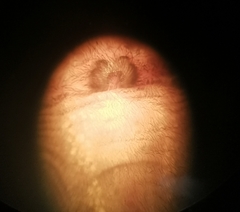 Cheiracanthium erraticum