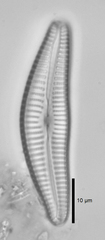 Cymbella