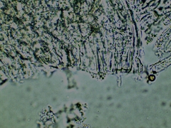 Inocybe erinaceomorpha