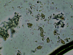 Inocybe erinaceomorpha