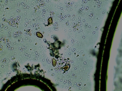 Inocybe erinaceomorpha