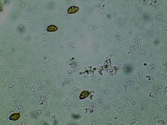 Inocybe erinaceomorpha