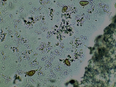 Inocybe erinaceomorpha