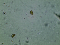 Inocybe erinaceomorpha