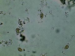 Inocybe erinaceomorpha