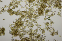Moesziomyces bullatus