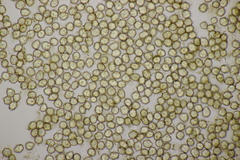 Moesziomyces bullatus