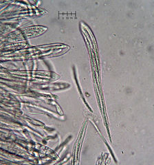 Coccomyces coronatus