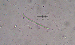 Coccomyces coronatus
