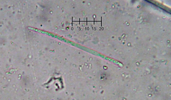 Coccomyces coronatus