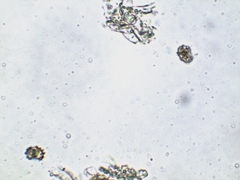 Thelephora anthocephala