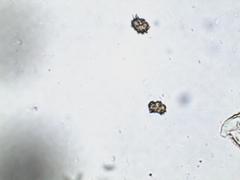 Thelephora anthocephala