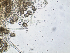 Thelephora anthocephala