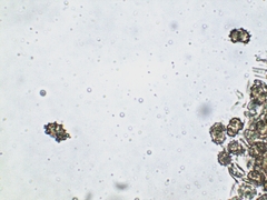 Thelephora anthocephala