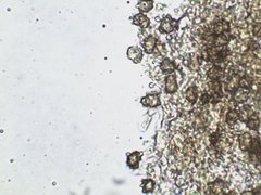 Thelephora anthocephala