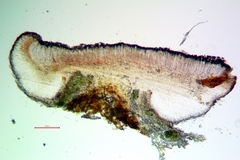 Bacidia heterochroa