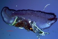 Bacidia heterochroa