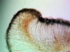 Bacidia heterochroa