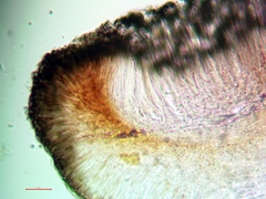 Bacidia heterochroa