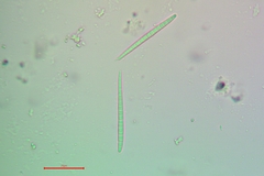 Bacidia heterochroa
