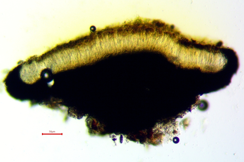 Cresponea chloroconia