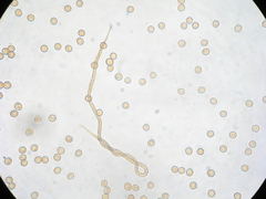 Trichia botrytis