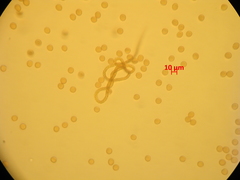 Trichia botrytis