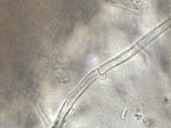 Scleroderma septentrionale