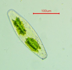 Netrium digitus