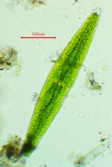 Netrium digitus