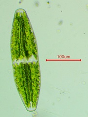 Netrium digitus