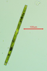 Pleurotaenium trabecula