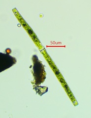 Pleurotaenium trabecula