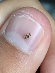 Corythucha juglandis