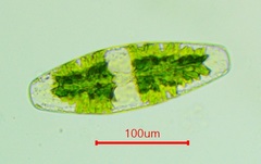 Netrium digitus