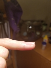 Nematocera
