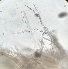 Monilinia