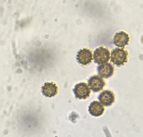 Trichaster (Photo 7 of 9)