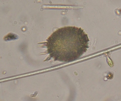 Trachelomonas armata