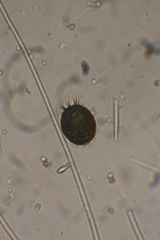 Trachelomonas armata