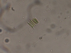 Scenedesmaceae