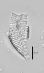 Cymbella