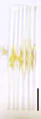 Fragilaria