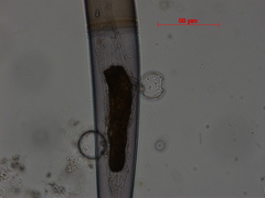 Chytridiomycota