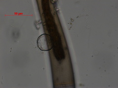 Chytridiomycota